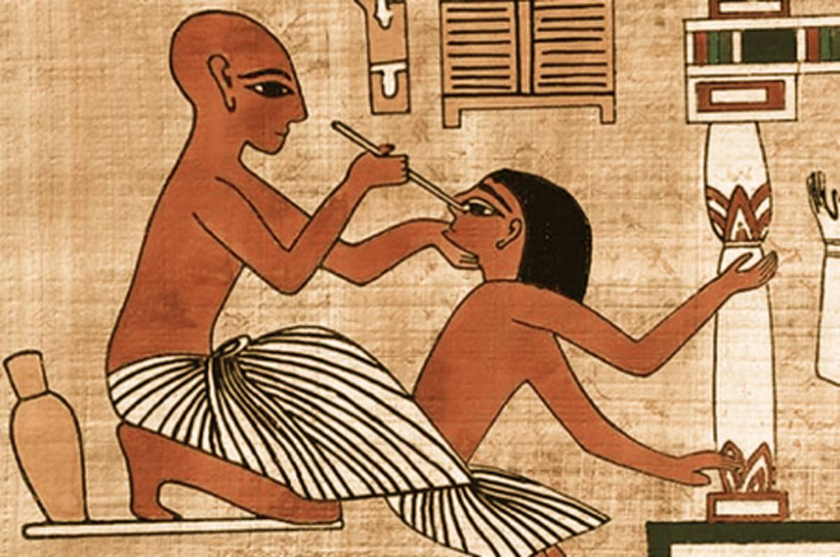  An Ancient Egyptian surgeon operates on a patient's brain tumor.